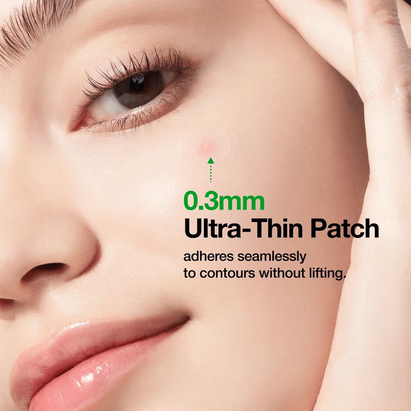 Anua Triple Acid Spot Care Microdart Patch – spuogų pleistrai 2