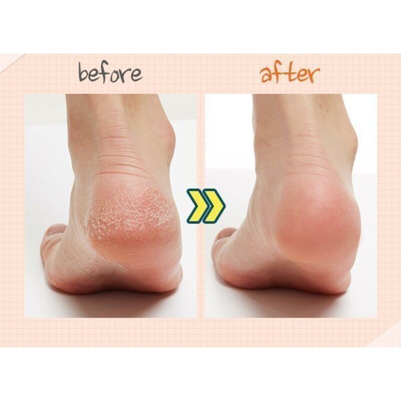 A'pieu Soft Foot 30 Minute Peeling Socks - rūgštinis pėdų šveitiklis